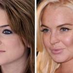 10 túlplasztikázott celeb